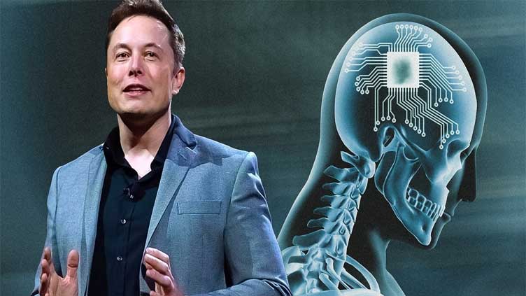 Elon Musk Neuralink Controversy